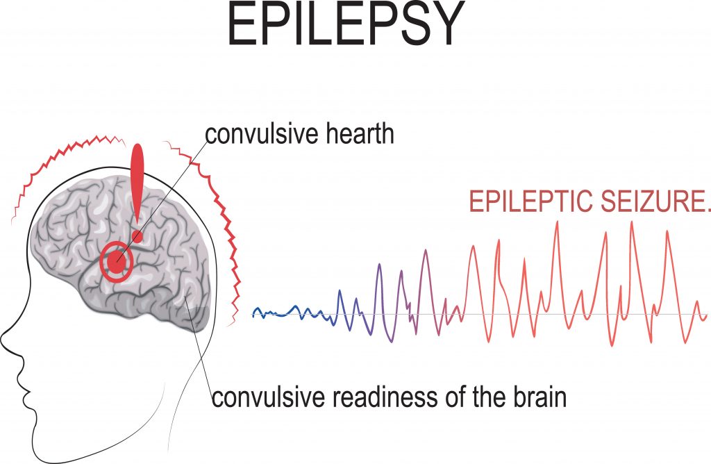 EEG