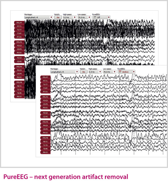 csm_Zuschnitt_Encevis_PureEEG_02_EN_Web_b7e77e9fcd