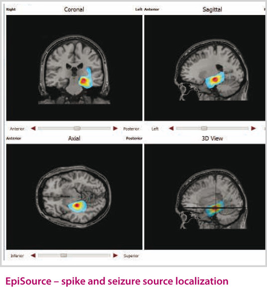 csm_Zuschnitt_Produkte_Encevis_EpiSource_03_EN_Web_8f282fa848